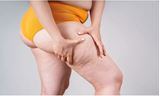 Kit para Tratamento do Lipedema
